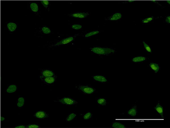 HCLS1 monoclonal antibody (M01), clone 3D5