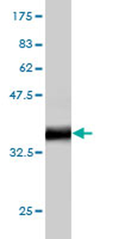 HCK monoclonal antibody (M02), clone 2A6