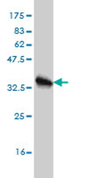 HBB monoclonal antibody (M01), clone 2H3
