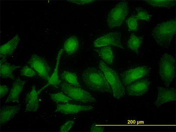 HADHSC monoclonal antibody (M01), clone 4B5