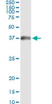 HADHSC monoclonal antibody (M01), clone 4B5
