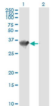 HADHSC monoclonal antibody (M01), clone 4B5