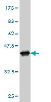 HADHSC monoclonal antibody (M01), clone 4B5