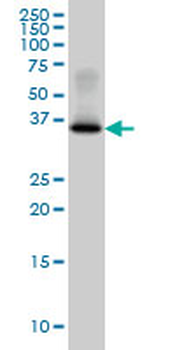 GYG1 monoclonal antibody (M07), clone 3B5