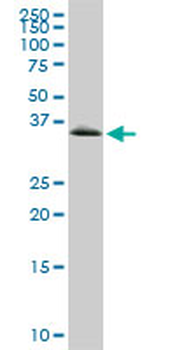 GYG1 monoclonal antibody (M07), clone 3B5