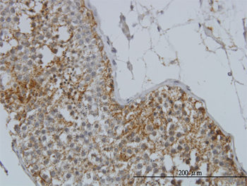GYG1 monoclonal antibody (M07), clone 3B5