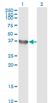 GYG1 monoclonal antibody (M07), clone 3B5