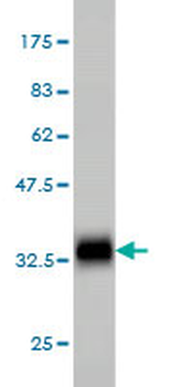 GYG1 monoclonal antibody (M07), clone 3B5