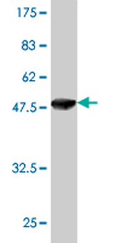 GUK1 monoclonal antibody (M01), clone 4C3-1A7