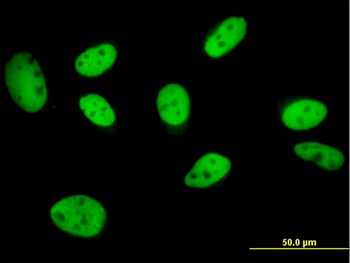 GTF2I monoclonal antibody (M01), clone 3E2