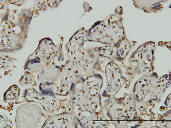 GTF2I monoclonal antibody (M01), clone 3E2