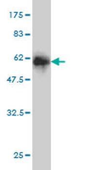 GTF2I monoclonal antibody (M01), clone 3E2