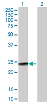 GSTP1 purified MaxPab rabbit polyclonal antibody (D01P)