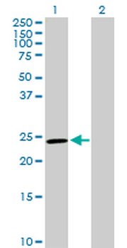 GSTM5 purified MaxPab rabbit polyclonal antibody (D01P)