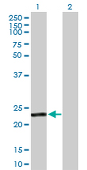 GSTA4 purified MaxPab rabbit polyclonal antibody (D01P)