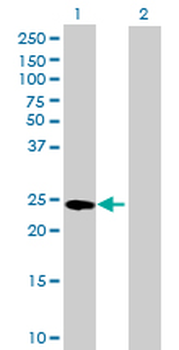 GSTA4 purified MaxPab mouse polyclonal antibody (B01P)
