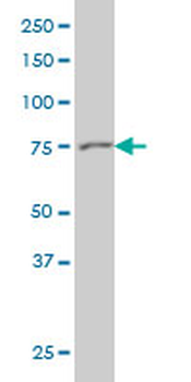 GSN monoclonal antibody (M01), clone 3G5