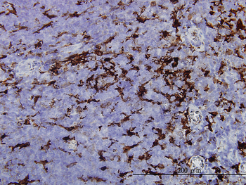 GSN monoclonal antibody (M01), clone 3G5