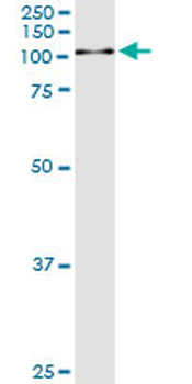 GSN monoclonal antibody (M01), clone 3G5