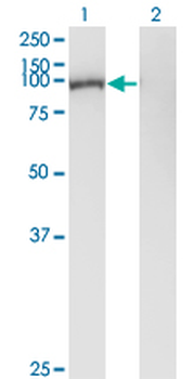 GSN monoclonal antibody (M01), clone 3G5