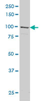 GRID1 monoclonal antibody (M01), clone 1A9