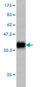 GRID1 monoclonal antibody (M01), clone 1A9