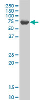 GRK6 monoclonal antibody (M10), clone 8D4