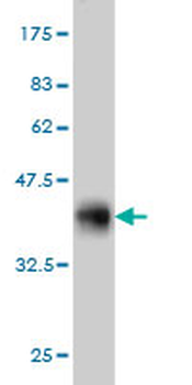 GRK6 monoclonal antibody (M10), clone 8D4