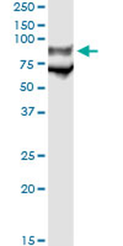 GP1BA monoclonal antibody (M02), clone 1C6