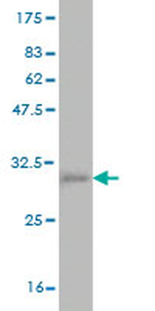 GP1BA monoclonal antibody (M02), clone 1C6