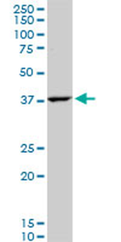 GOT2 polyclonal antibody (A01)