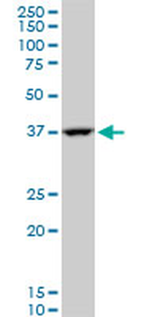 GOT2 polyclonal antibody (A01)