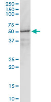 GNAI1 monoclonal antibody (M01), clone 2B8-2A5