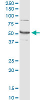 GLUD2 monoclonal antibody (M01), clone 3C2