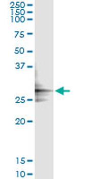 GLUD2 monoclonal antibody (M01), clone 3C2
