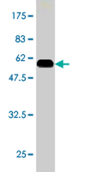 GLUD2 monoclonal antibody (M01), clone 3C2