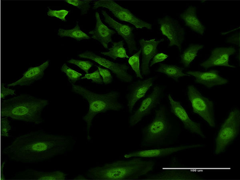 GLI1 monoclonal antibody (M02), clone 1G11