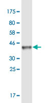 GLI1 monoclonal antibody (M02), clone 1G11
