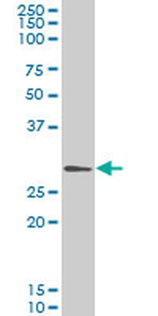 GCLM monoclonal antibody (M01), clone 2B8