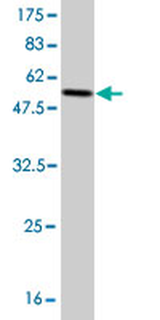 GCLM monoclonal antibody (M01), clone 2B8
