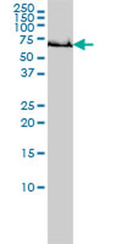 GCLC monoclonal antibody (M01), clone 3H1