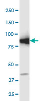 GCLC monoclonal antibody (M01), clone 3H1