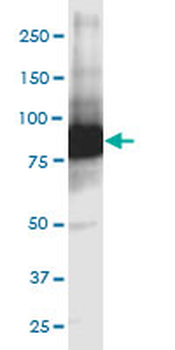GCLC monoclonal antibody (M01), clone 3H1
