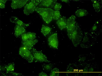 GCLC monoclonal antibody (M01), clone 3H1