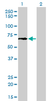 GCLC monoclonal antibody (M01), clone 3H1