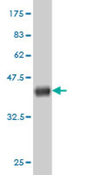 GCLC monoclonal antibody (M01), clone 3H1