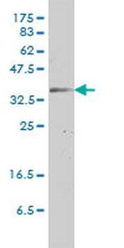 GJB3 monoclonal antibody (M01), clone 3B4-1B3
