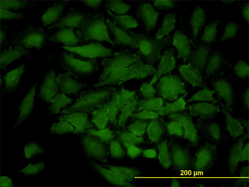 GJB3 monoclonal antibody (M01), clone 3B4-1B3