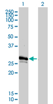 GJB3 monoclonal antibody (M01), clone 3B4-1B3