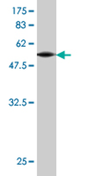 GJB3 monoclonal antibody (M01), clone 3B4-1B3